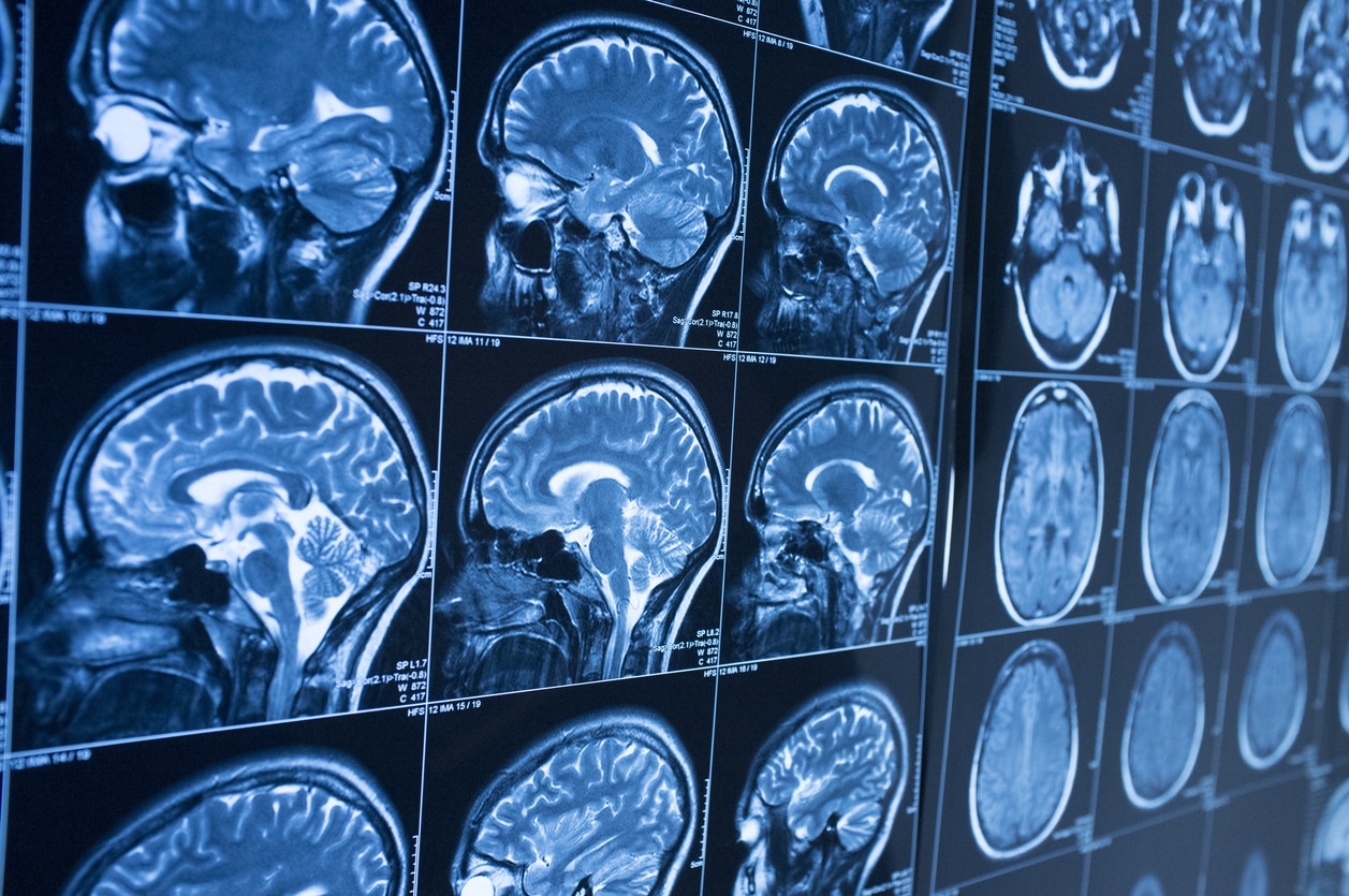 Medical Images Recognition Solution Medical Images Recognition Solution