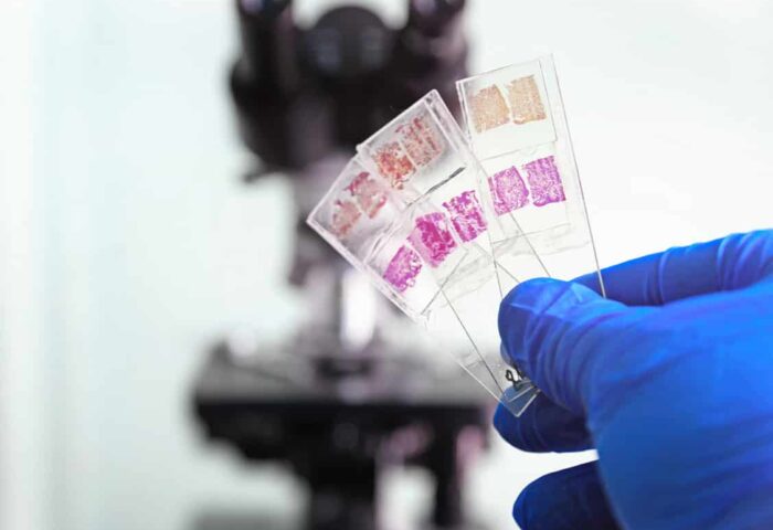 Glass slides in the laboratory