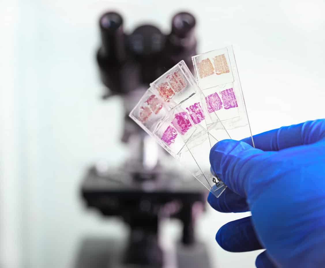 Automated Mapping Tool For Biopsy Plates Automated Mapping Tool For Biopsy Plates