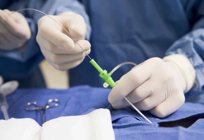 Visualization System for Smart Catheter Visualization System for Smart Catheter
