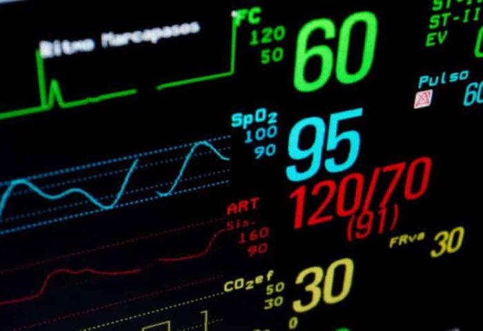 Critical Care Monitoring System Critical Care Monitoring System