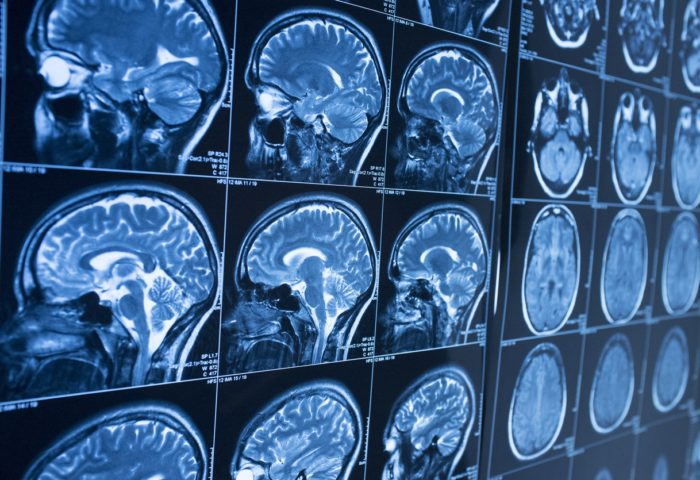 Medical Images Recognition Solution Medical Images Recognition Solution