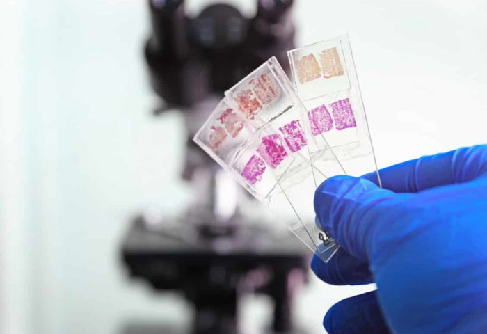 Automated Mapping Tool For Biopsy Plates Automated Mapping Tool For Biopsy Plates