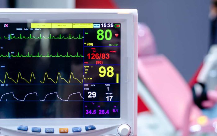 How to Improve ECG Rhythm Recognition Using a DCNN