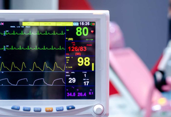 How to Improve ECG Rhythm Recognition Using a DCNN